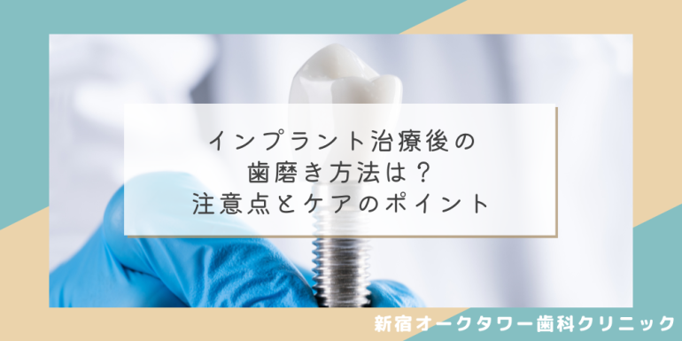 インプラント治療後の歯磨き方法は？注意点とケアのポイント