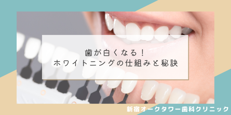 歯が白くなる！ホワイトニングの仕組みと秘訣