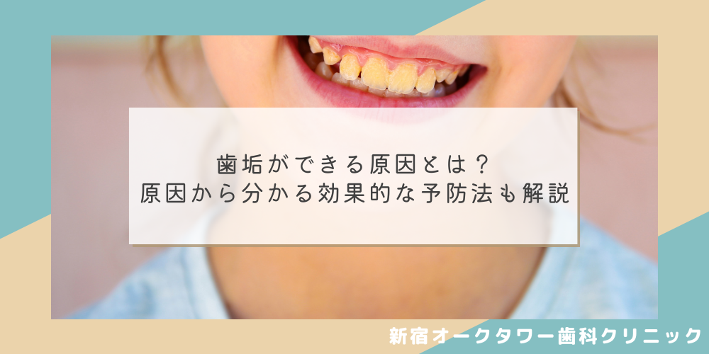 歯垢ができる原因とは?原因から分かる効果的な予防法も解説