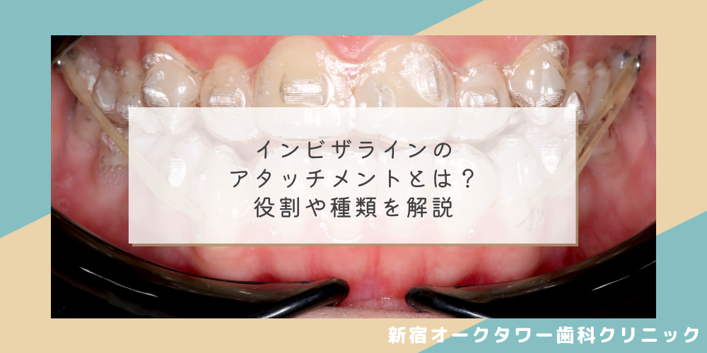 インビザラインのアタッチメントとは？役割や種類を解説