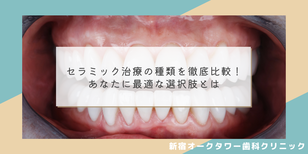 【美しさと耐久性】セラミック治療の種類を徹底比較！あなたに最適な選択肢とは