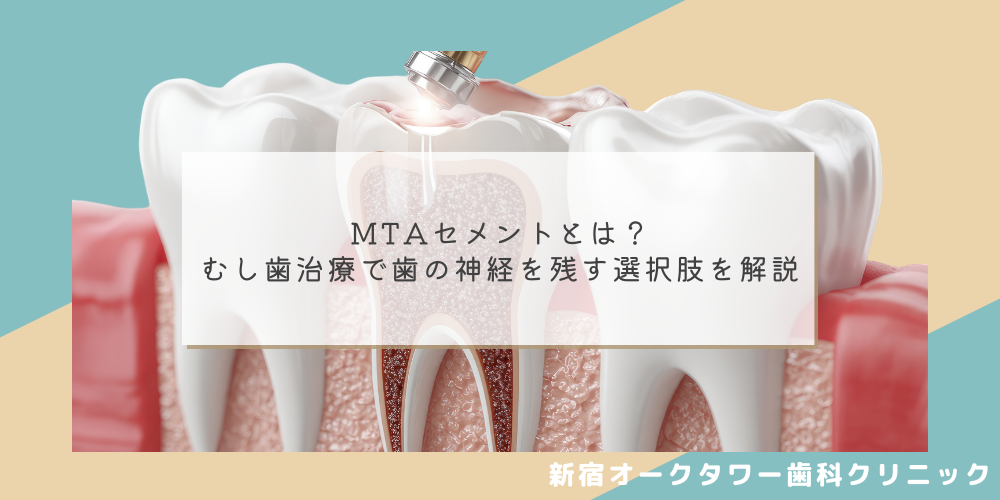 MTAセメントとは？むし歯治療で歯の神経を残す選択肢を解説