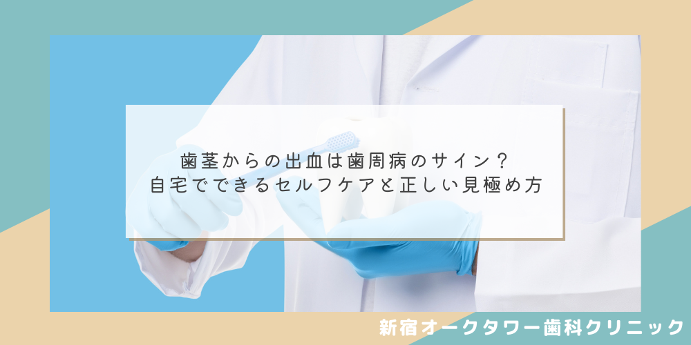 歯茎からの出血は歯周病のサイン？自宅でできるセルフケアと正しい見極め方