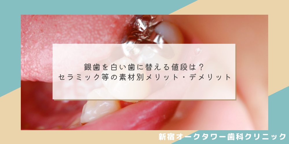 銀歯を白い歯に替える値段は？セラミック等の素材別メリット・デメリット