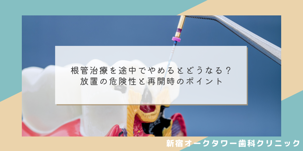 根管治療を途中でやめるとどうなる？放置の危険性と再開時のポイント