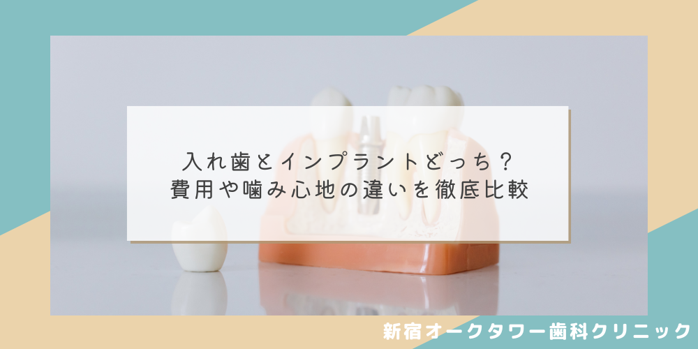 入れ歯とインプラントどっち？費用や噛み心地の違いを徹底比較